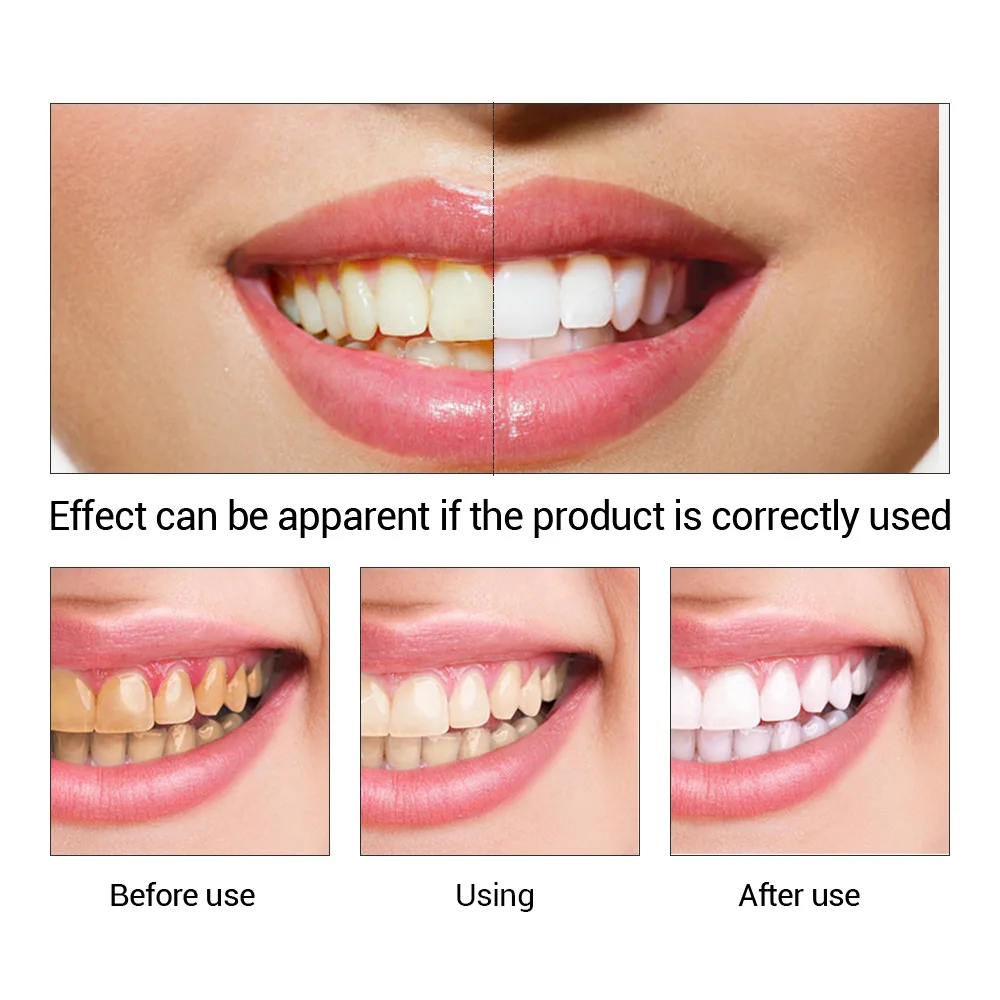 FTEENPLY Teeth Whitening Essen - Teeth Whitening Bleach recension och pris