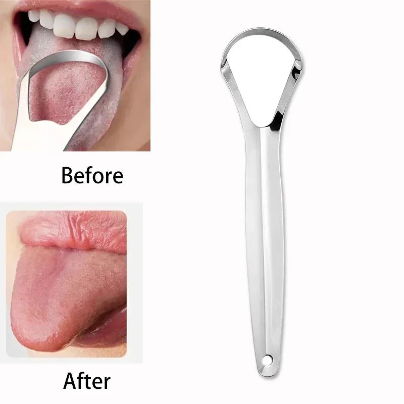 Halitosis Tongue Coating Tongu - Tongue Scraper Metal recension och pris