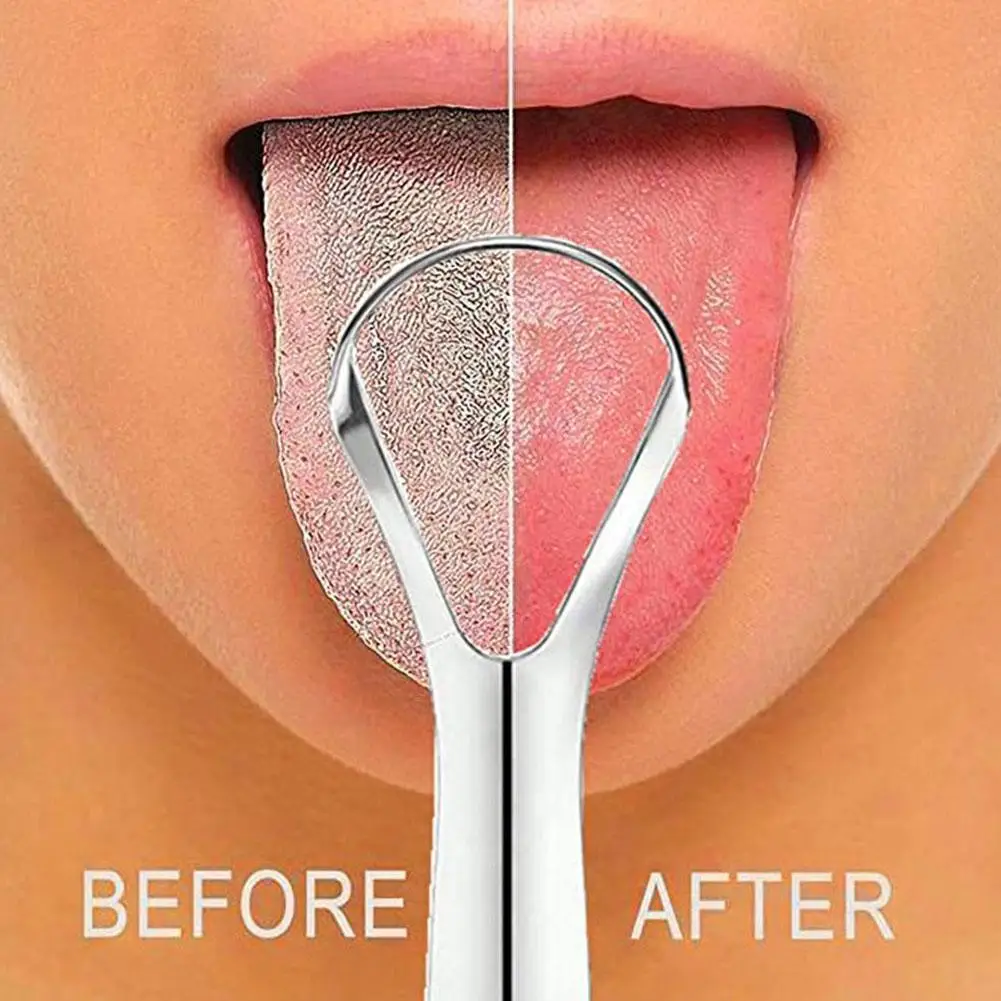 1-20pc Tongue Scraper, Stainle - Tongue Scraper Metal recension och pris