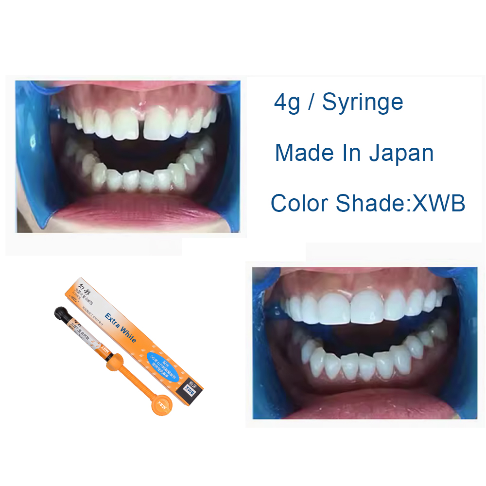 Dental Composite Resin Extra W - Teeth Whitening Professional recension och pris